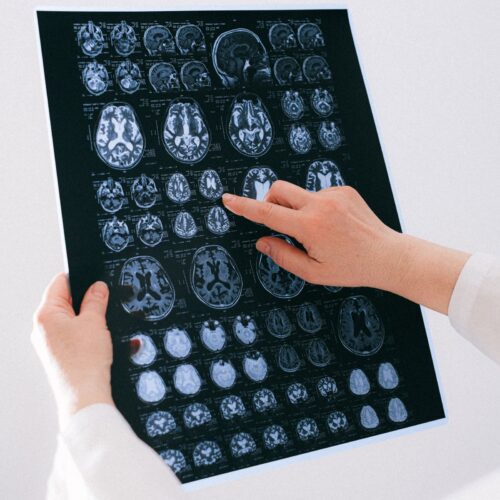 Strategische PR für Precisis – MedTech im Fokus