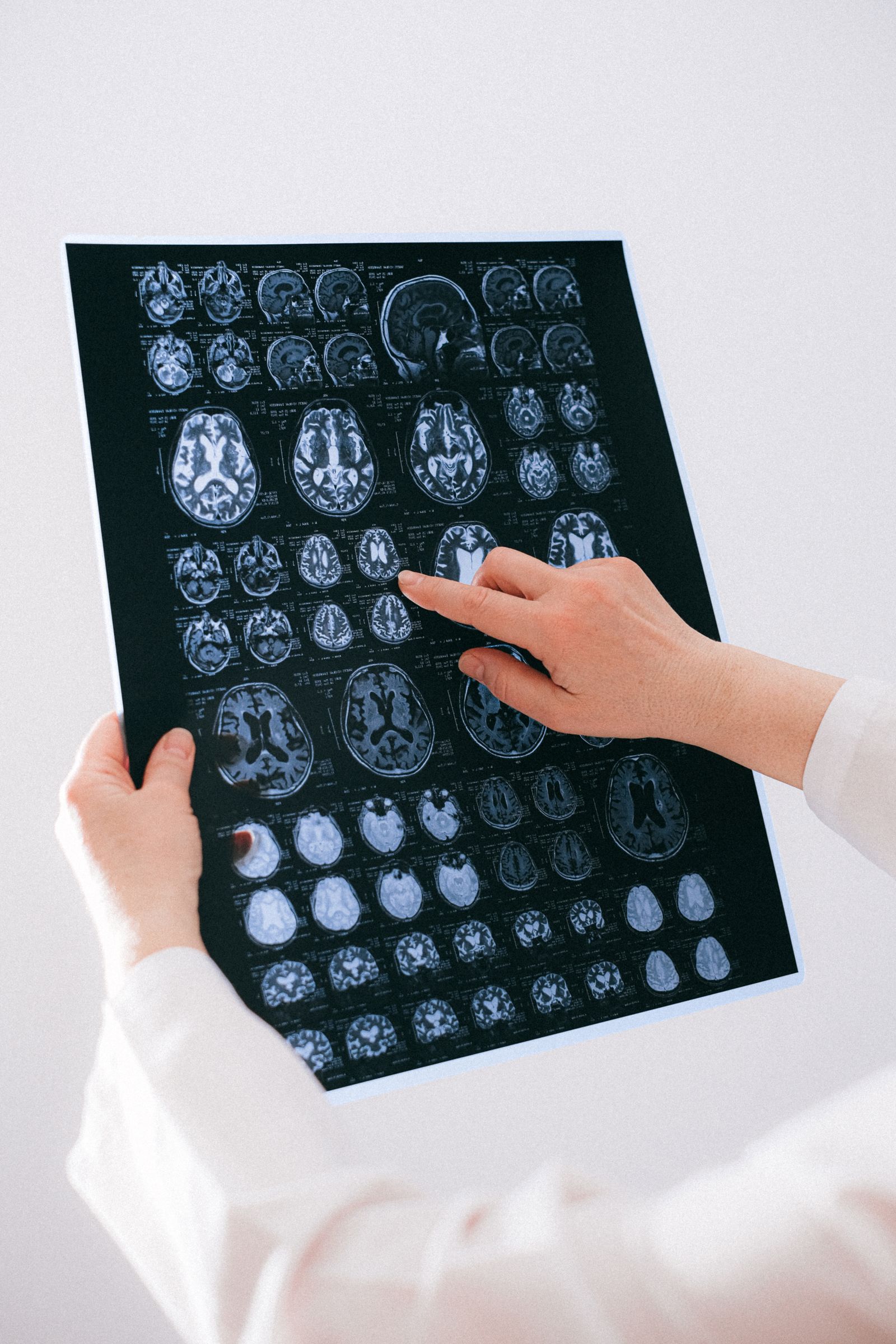 Strategische PR für Precisis – MedTech im Fokus